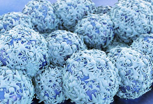 The actual cause of developing cervical cancer is still being researched. However, studies suggest that cervical cancer may be caused by infection with certain strains of human papillomavirus (HPV).