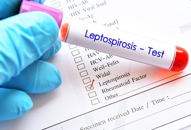 Leptospirosis is a zoologic disease that humans contract through contact with infected animal urine. People who are most at risk of getting leptospirosis live in poor sanitary conditions like urban slums and tropical climate regions that are prone to flooding.