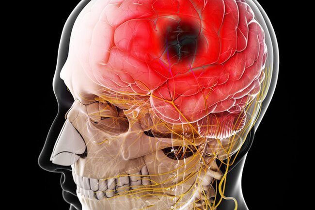 COVID-19 appears to cause problems with your nervous system as well, including seizures.