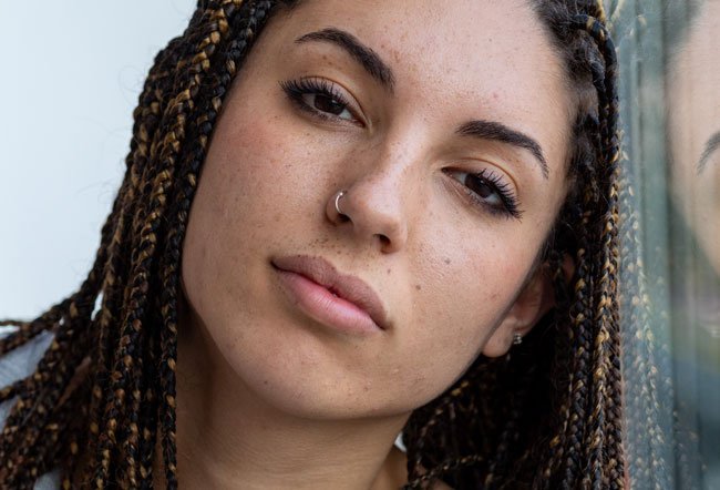 keloid nose piercing