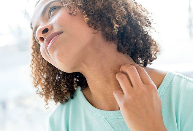 histamine intolerance