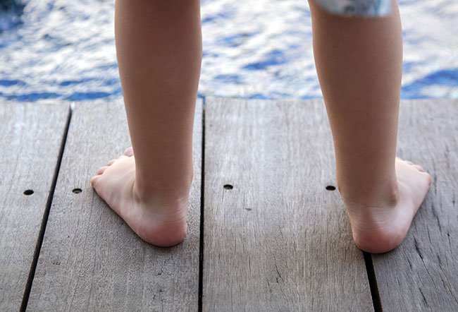 overpronation