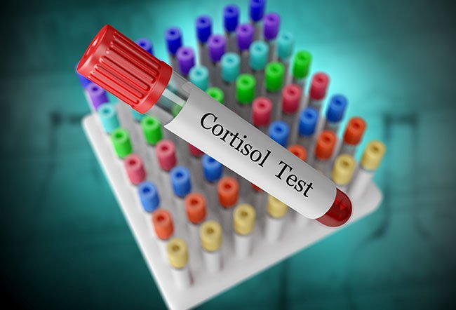 Adrenal fatigue is not a recognized medical diagnosis.