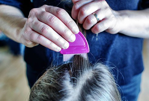 Do Head Lice Live on Pillows