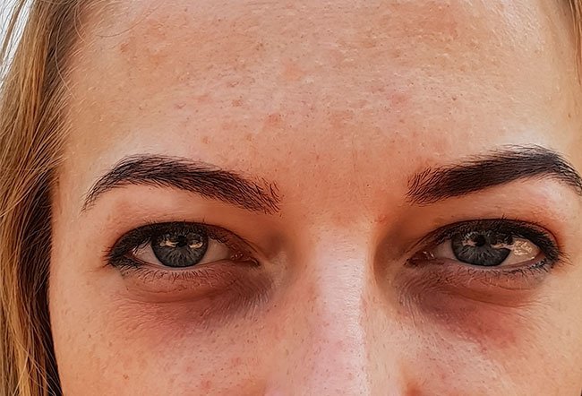 Bags and shadows under your eyes are a common occurrence.