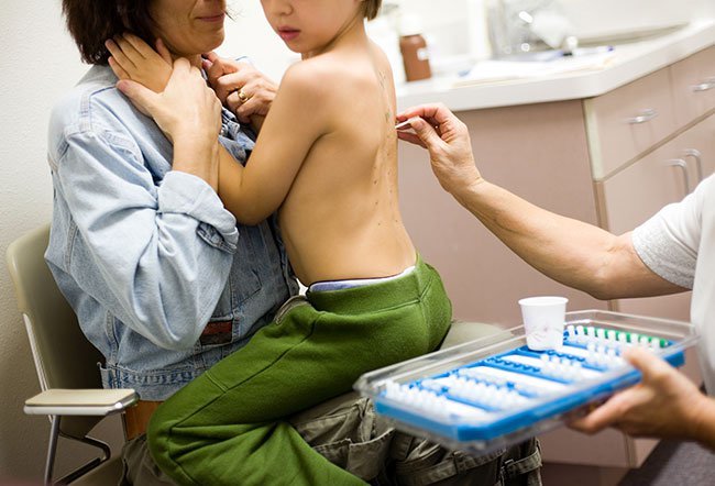 A food allergy is a condition that causes your immune system to fight against a particular part of food — which is called an allergen. Food allergies can be hereditary — that is, parents can pass the likelihood of developing a food allergy to their children through genes that code for inherited traits.