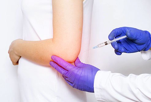 A lateral epicondyle injection injects the corticosteroid medication to reduce the pain and inflammation in lateral epicondylitis, or tennis elbow.