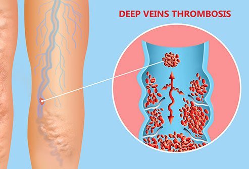 Leg pain can occur as a result of various conditions