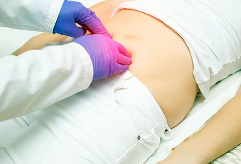 Surgery is the only definitive way to treat a hernia.