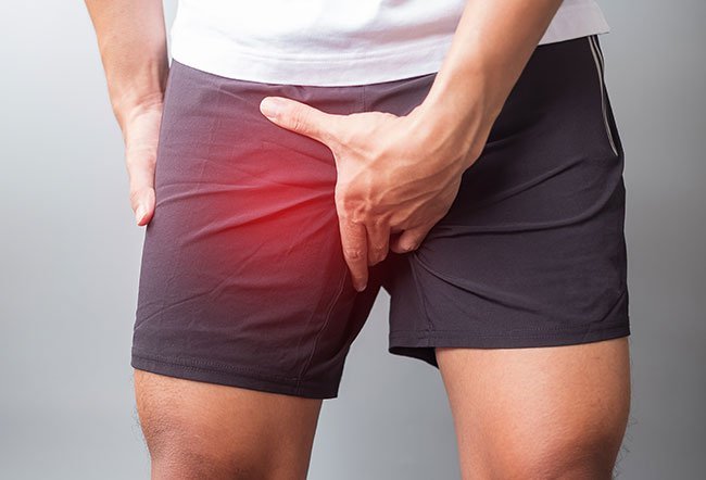 how do you treat a groin strain