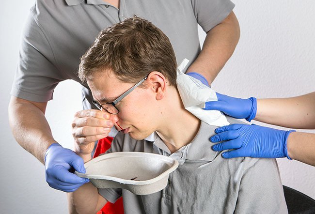 Posterior nasal packing is a procedure to control the bleeding from the behind (posterior aspect) of the nose.