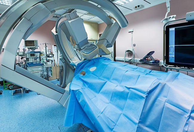A pulmonary angiography detects problems in the blood flow of the pulmonary vessels. The results of the procedure are shown as a moving X-ray known as a pulmonary angiogram. Doctors need to insert a catheter into your arm or groin and thread it through your veins to your heart as part of the procedure.