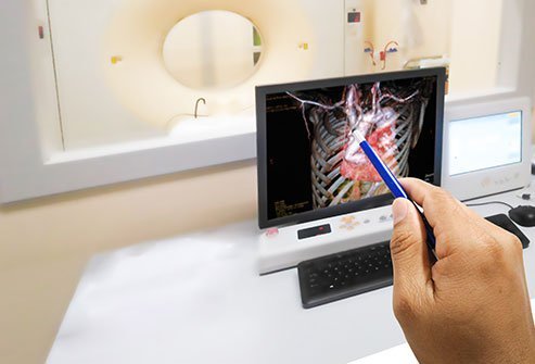Angiogram and angioplasty are two procedures that are used to treat or assess issues with blood vessels.