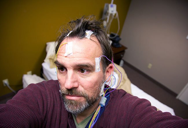 Endoscopic sphenoidotomy is the surgical opening of the sphenoid sinus using an endoscope