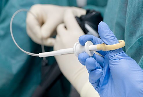 A bronchoscopy is a procedure used to diagnose upper respiratory conditions. 