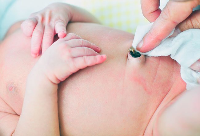 The cord will normally fall off in one to three weeks after birth. The average cord falls off between 10 and 14 days with 21 days being the higher side of normal.