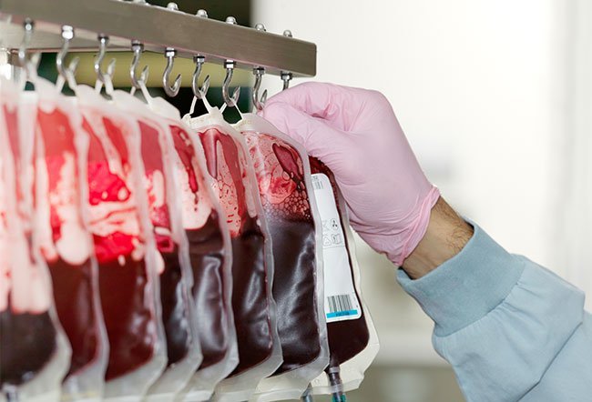 how many pints of blood are there in the human body