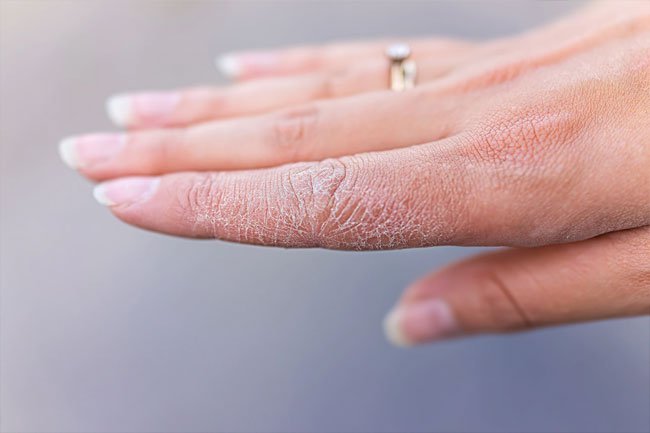 Washing your hands is an important part of curbing the spread of COVID-19, but doing it often can break down the natural oils that protect your hands and dry them out.
