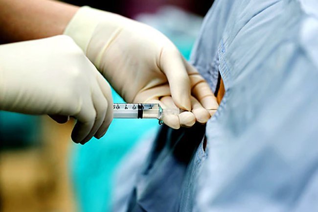 An epidural injection may help if nothing else does.