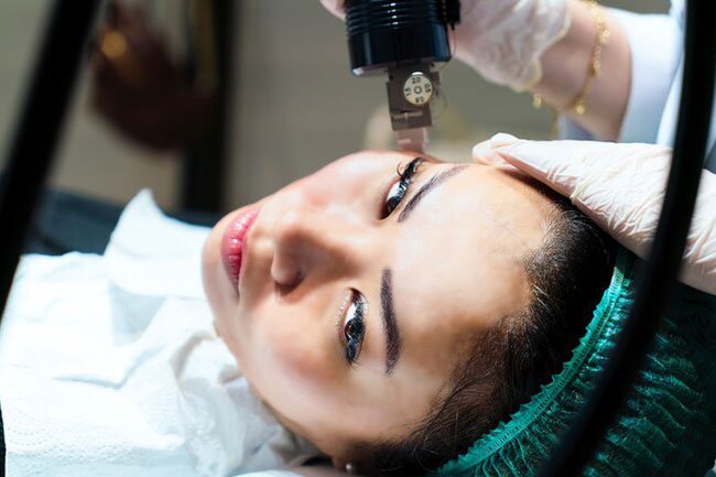 In this procedure, the doctor uses fine needles to make tiny, evenly spaced holes in your skin.