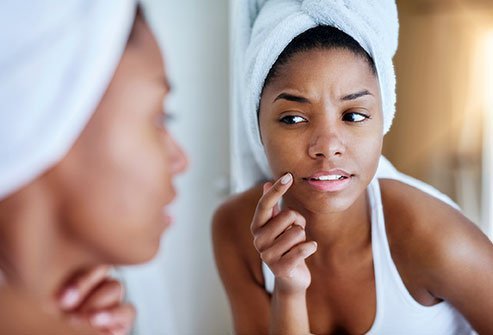 You can make pimples go away fast by using medications and home care. Medications for pimples include antibiotics, birth control pills, and topical products containing benzoyl peroxide, retinoids, or salicylic acid. Home care for pimples includes cleaning your skin, avoiding oil-based cosmetics, avoiding rubbing alcohol and toners, and shampooing oily hair.