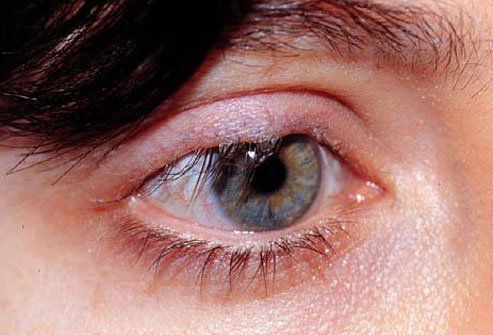 Eyelids may turn inward or outward as people age.
