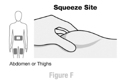 The thigh injection site is shown here - Illustration