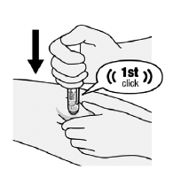 Begin Injection - Illustration