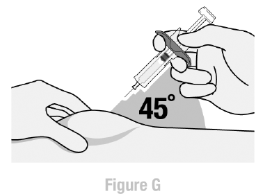 Injecting angle - Illustration
