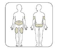 Choose your injection site - Illustration