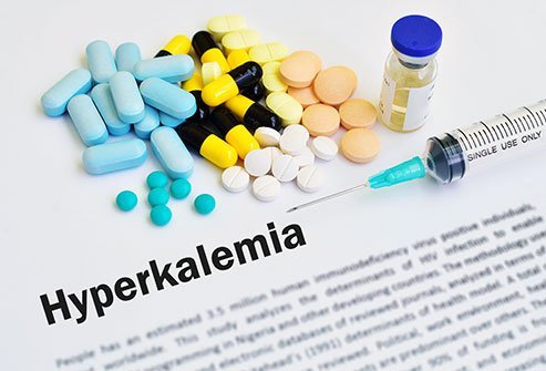 Hyperkalemia, an abnormally high level of blood potassium, sometimes causes symptoms.