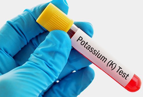 Hypokalemia is defined as decreased potassium levels in the body. Hypokalemia is defined as decreased potassium levels in the body.