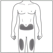 choose your injection site - Illustration