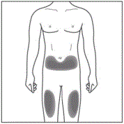 choose your injection site - Illustration