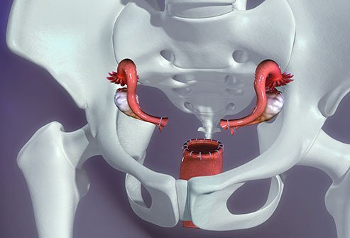 Hysterectomy is the surgical removal of the uterus.