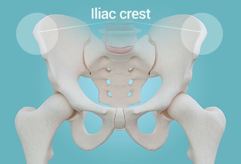 Iliac Crest Tissue