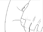 Pinching the skin is important to help make sure that you inject the medicine under the skin (into fatty tissue) but not any deeper (into the muscle). - Illustration