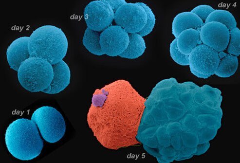 Blastocyst transfer is a relatively new IVF technology.