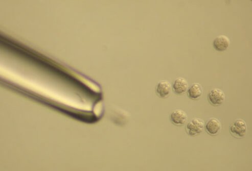 Donor embryos are embryos donated by couples who have completed the IVF process.