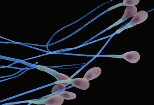 Male factors are responsible in about 40% of infertile couples.