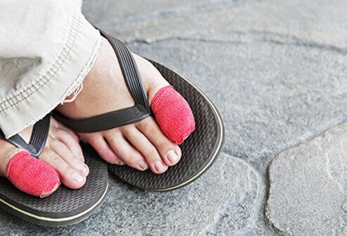 When home remedies aren't enough to treat an ingrown toenail or the condition is associated with severe pain or infection, surgery may be necessary.