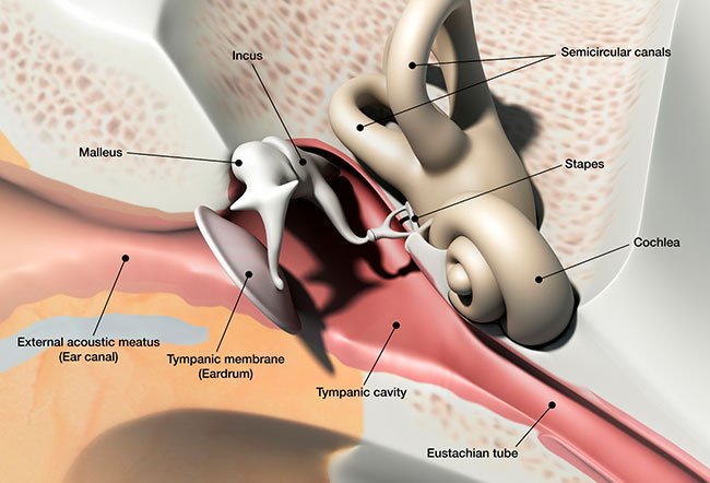 Vestibular neurectomy is one of the surgical treatments for Meniere's disease (dizzy spells with hearing loss).