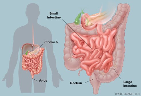 Picture of Intestines