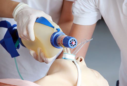 Endotracheal intubation is a procedure to administer mechanical ventilation through a tube inserted in the airway.