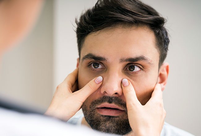 The sinuses are cavities present in the facial bones.