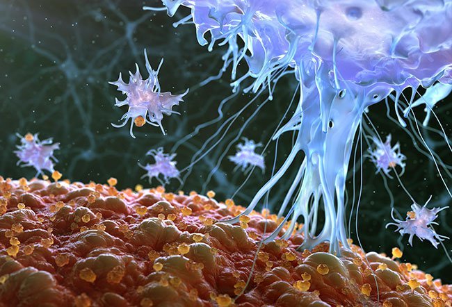 Leukemia is the cancer of the white blood cells of the bone marrow