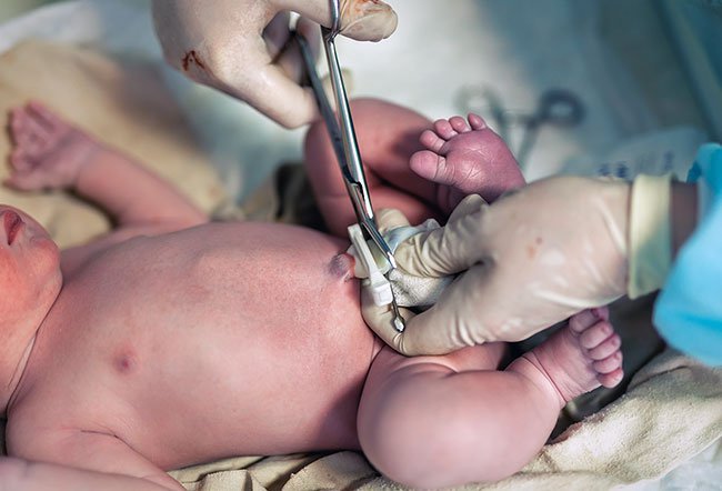 The American College of Obstetricians and Gynecologists and the American Academy of Pediatrics (AAP) do not recommend routinely banking cord blood with private banks. It is advisable to donate cord blood to a public cord blood bank to provide life-saving stem cells to a person in need.