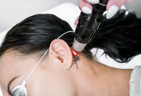 Temporary tattoos usually fade in a few days to a few weeks.