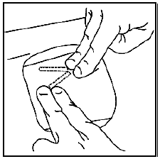 Palpate the area to locate both implants - Illustration