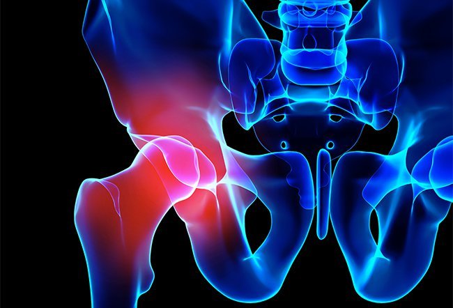 Tendonitis causes pain and inflammation in the tendons. Hip tendonitis feels like a dull ache that causes difficulty moving.